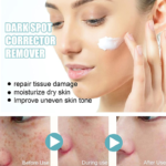 Dark Spot Corrector Remover Daily Face Serum - Image 3